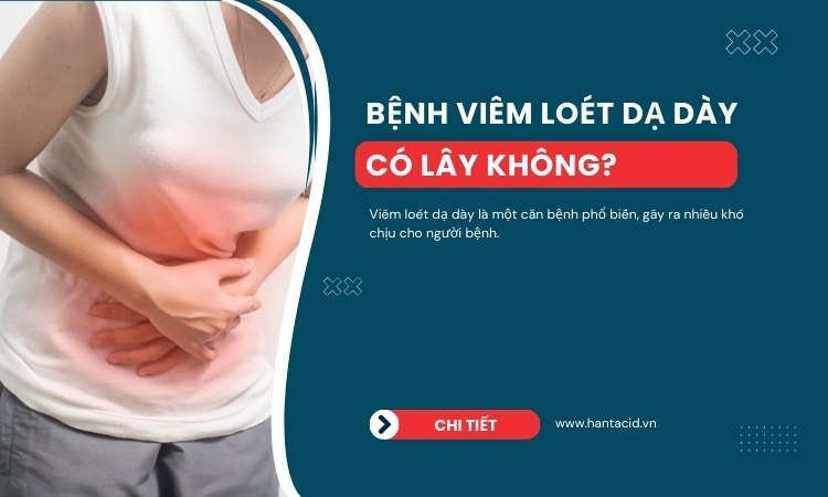 Bệnh viêm loét dạ dày có lây không?